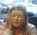 erst thumb