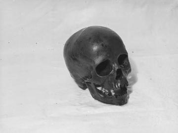 Archäologische Ausgrabungen am Dümmersee 1938, Funde aus der jüngeren Steinzeit: Schädel einer 24-jährigen Frau.