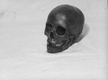 Archäologische Ausgrabungen am Dümmersee 1938, Funde aus der jüngeren Steinzeit: Schädel einer 24-jährigen Frau.