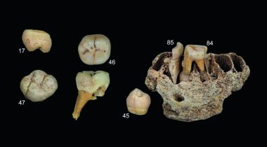 Zähne und ein Unterkieferfragment eines jungen Kindes, das in der Altsteinzeit um 10.000 v. Chr. lebte und in der Blätterhöhle in Hagen entdeckt wurde.<br>Foto: Landesamt für Denkmalpflege und Archäologie Sachsen- Anhalt/J. Orschiedt