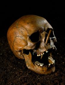 Ein etwa 5000 Jahre alter Schädel mit einer Pfeilschussverletzung aus dem dänischen Porsmose.<br>Foto: Dänisches Nationalmuseum Kopenhagen.